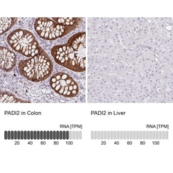 PADI2 Antibody, Novus Biologicals 0.1mL; Unlabeled:Antibodies, Polyclonal